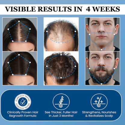 Hair Growth Roll on Serum