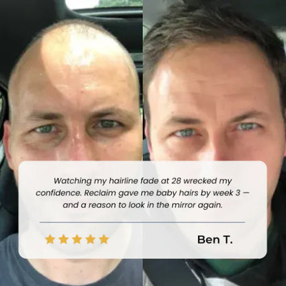 Hair Growth Roll on Serum